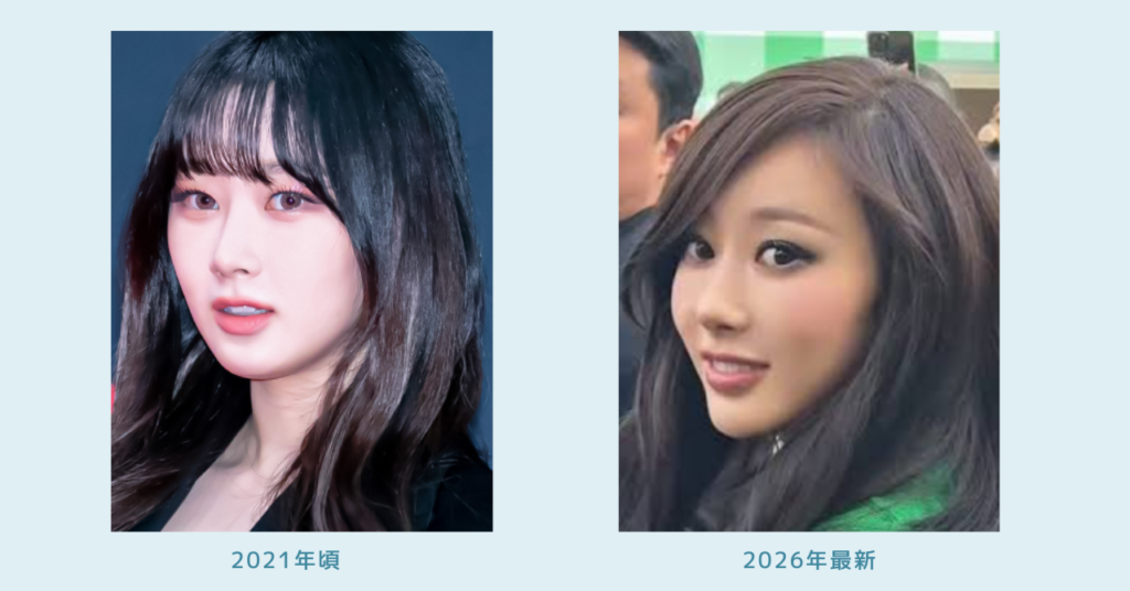 ジゼルの2021年頃と2026年最新の斜め顔比較画像。目元、鼻筋、輪郭、顎まわりの印象の違いが分かる2枚の写真。