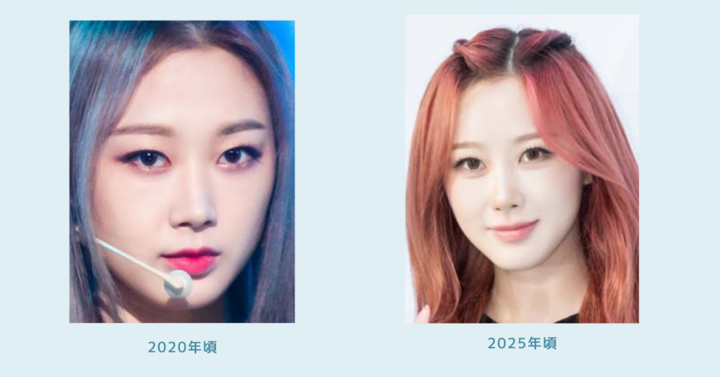 ジゼルのデビュー時(2020年)と2026年3月の顔画像比較。目元、鼻筋、輪郭、顎まわりの印象の違いが分かる2枚の写真。