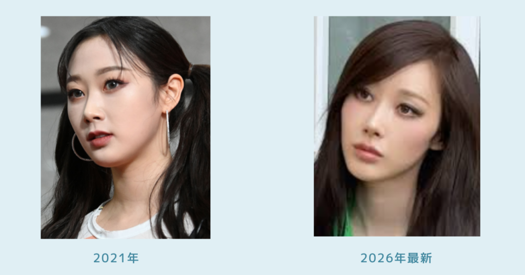 ジゼルの2021年と2026年最新の横顔寄り比較画像。鼻筋、フェイスライン、顎先の印象の違いが分かる2枚の写真。