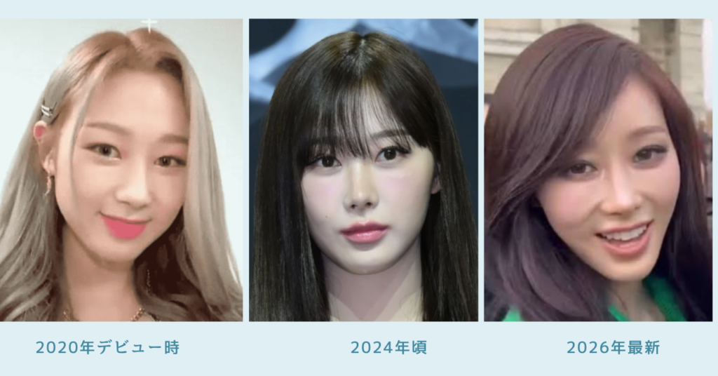 ジゼルの2020年デビュー時、2024年頃、2026年最新画像を並べた比較写真。目元、鼻筋、輪郭、顎まわりの印象変化が分かる3枚の画像。